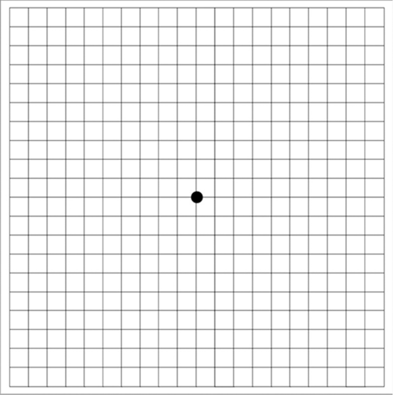 Amsler Grid
